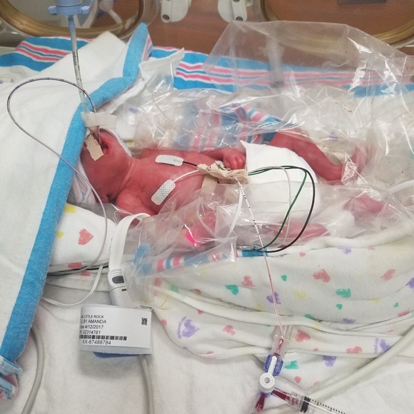 Plz Read Meet the Posher - Involuntarily Childless - Picture 3 of 8